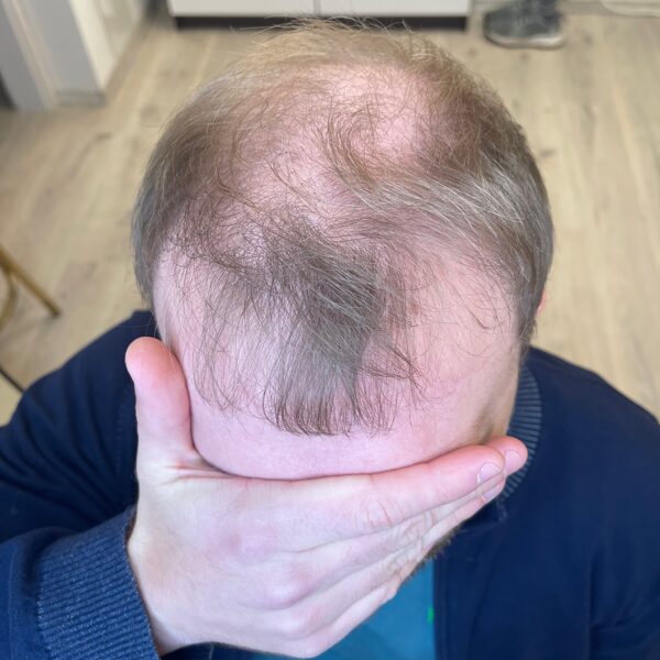 Pirms /gaišu matu īpašnieks